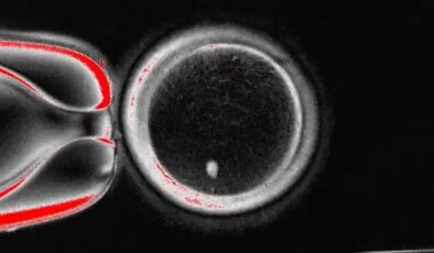 Kısırlık tedavisinde tarihi adım: Deri hücresinden yumurta üretilmeye başlandı
