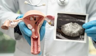 Polikistik over sendromlu kadınlarda zaman algısı araştırıldı