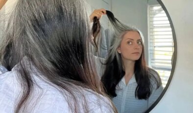 Saçın erken beyazlamasının nedenleri neler, eski saçları geri getirmek mümkün mü?