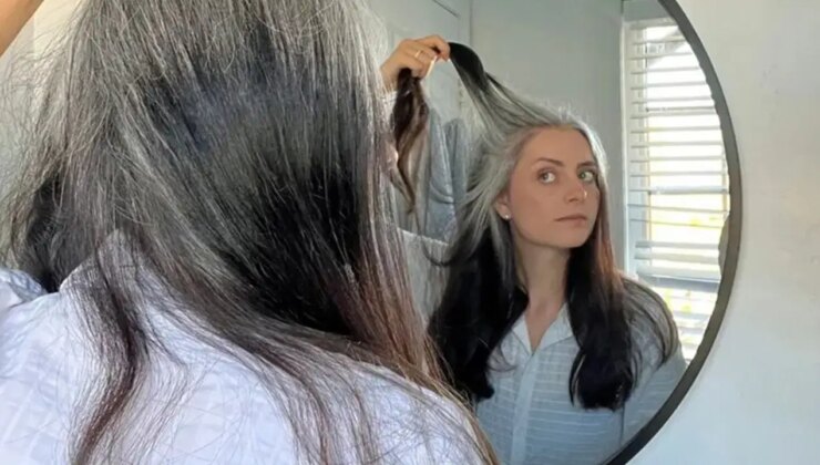 Saçın erken beyazlamasının nedenleri neler, eski saçları geri getirmek mümkün mü?