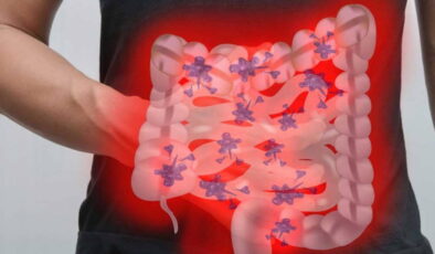 Şişkinlik hissine son veriyor, yaşam kalitesini artırıyor: Huzursuz bağırsak sendromuna şifa olan 8 kür