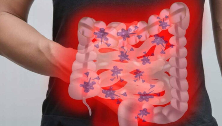 Şişkinlik hissine son veriyor, yaşam kalitesini artırıyor: Huzursuz bağırsak sendromuna şifa olan 8 kür