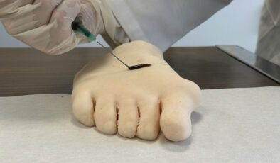 Türk akademisyen, insan saçından doku yapıştırıcı üretti