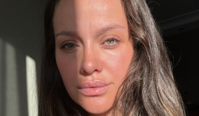 Ünlü oyuncu İrem Helvacıoğlu korkutan kazayı anlattı