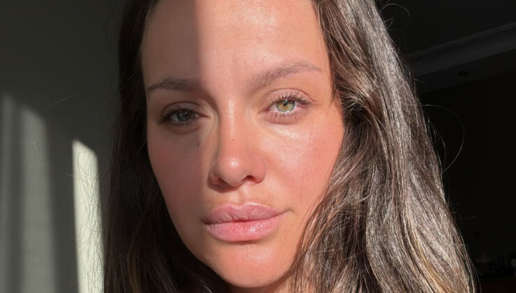 Ünlü oyuncu İrem Helvacıoğlu korkutan kazayı anlattı