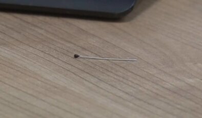 2 yaşındaki çocuğun bağırsağından 3 santimlik iğne çıktı!