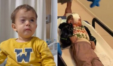 Baba, fırıncıyı daha önce uyarmış! 2 yaşındaki Alpaslan gözünü kaybetti