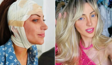 Barbie bebeğe benzemek için 27 kez ameliyat oldu: Brezilyalı fenomen 31 yaşında hayatını kaybetti