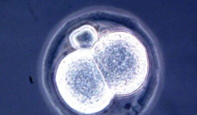 Bilim dünyası alarmda: Laboratuvarda üretilen embriyolar gerçeğe her geçen gün yaklaşıyor