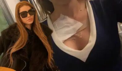 Bir estetik skandalı daha! Defalarca kez ameliyat oldu: Doktor, ‘Yan tarafta mezarlık var, çok kişi gömdük’ dedi…