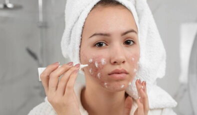 Cilt sorunlarının gizli tetikleyicileri:  Akneye yol açan 10 alışkanlık