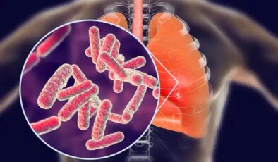 DSÖ: Tüberküloz nedeniyle her yıl bir milyon kişi hayatını kaybediyor