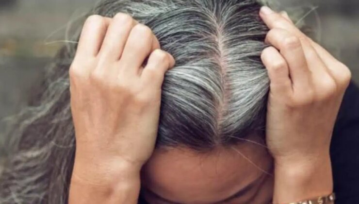 Gençlikte saç beyazlamasının nedeni ortaya çıktı: Kansere karşı vücudun gizli savunması olabilir