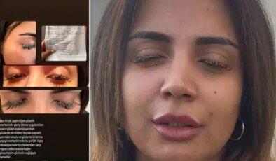 Güzellik merkezinde dehşet… Kirpiklerini yaptırmaya gitti kimyasal gözünü yaktı!