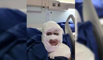 Kadıköy’de dehşet veren olay: Kadını yanıcı madde dökerek ateşe verdi!