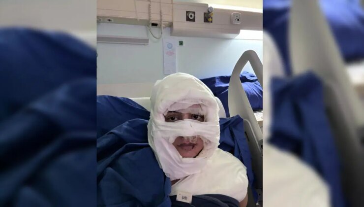 Kadıköy’de dehşet veren olay: Kadını yanıcı madde dökerek ateşe verdi!