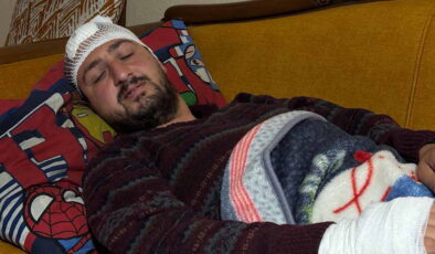 Kocaeli’de insanlık dışı saldırı: Otizmli şahıs odunluğa baktı diye odunla darbedildi