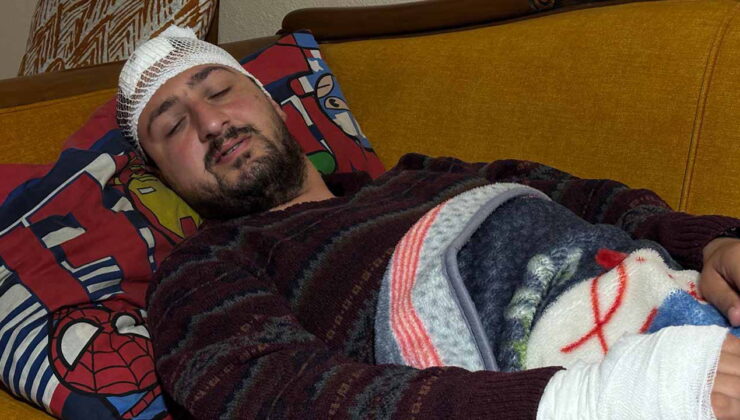 Kocaeli’de insanlık dışı saldırı: Otizmli şahıs odunluğa baktı diye odunla darbedildi