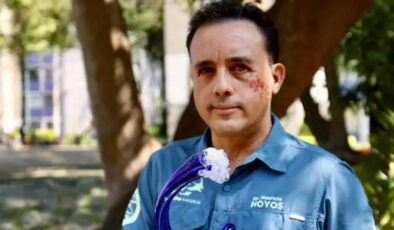 Köpekbalığı başından ısırdı, sağ kaldı: ‘Bu hayvan hayatımı bağışladı’