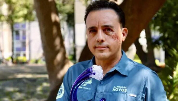 Köpekbalığı başından ısırdı, sağ kaldı: ‘Bu hayvan hayatımı bağışladı’