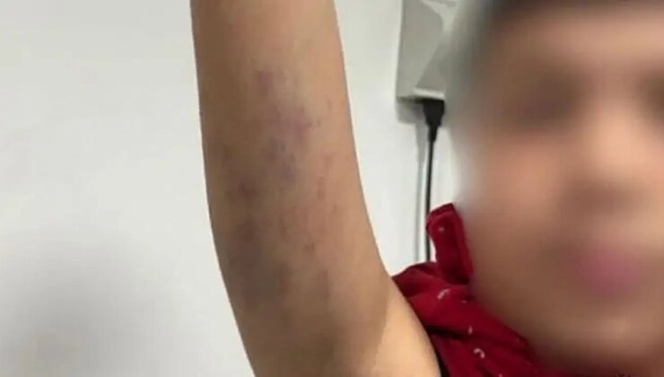 Otizmli öğrenciye darp iddiası: İstanbul İl Milli Eğitim Müdürlüğü açıklama yaptı