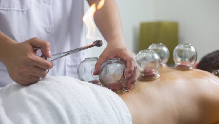 2025’in son hacamat günleri: Aralık ayı sünnetli hacamat takvimi