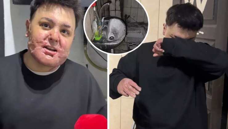 65 ameliyat geçirdi, 12 gün uyutuldu! Hayatı saniyeler içinde kabusa döndü