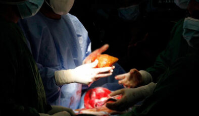 ABD’de kuduzlu böbrek nakli yapıldı: Hayatını kaybetti