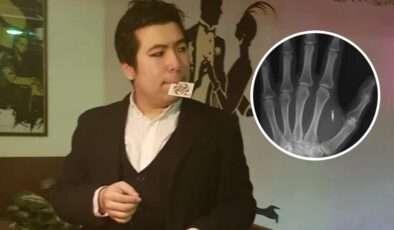 ABD’de moleküler biyolog, eline yerleştirdiği mikroçipin şifresini unuttu