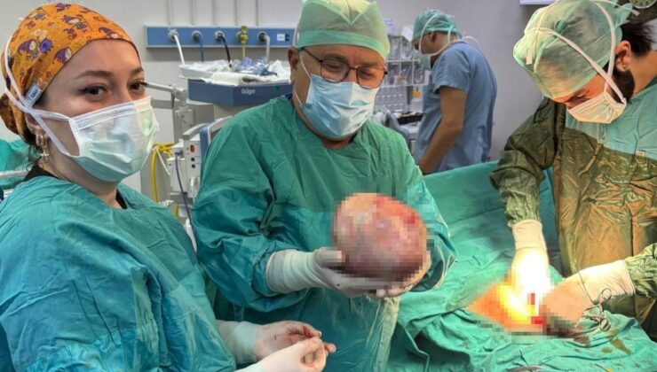 Amasya’da kadının şişen karnından 6 kiloluk kitle çıktı