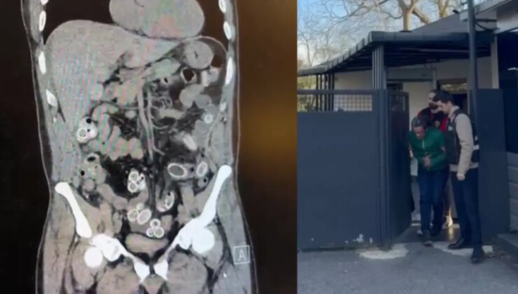 Ameliyatla çıkarıldı! Fas’tan Beşiktaş’a midesinde ‘uyuşturucu’ ile geldi