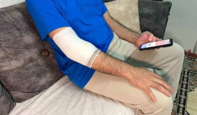 Başakşehir’de sitenin güvenlik görevlisine sahipli köpek saldırdı