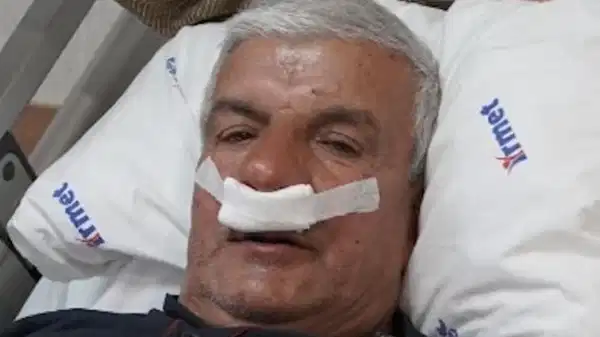 Burnundan 100 gramlık taş çıkarıldı