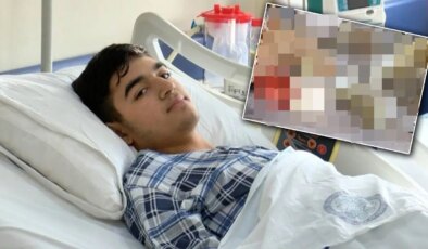 ‘Çiğ’ şekilde yedi, karaciğeri iflas etti… Bir lokma sonra kabus başladı!