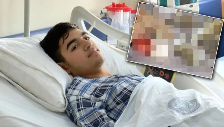 ‘Çiğ’ şekilde yedi, karaciğeri iflas etti… Bir lokma sonra kabus başladı!