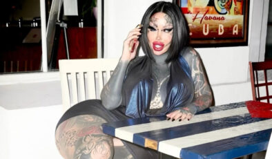 Estetik ameliyatlarıyla ünlü model hayatını kaybetti