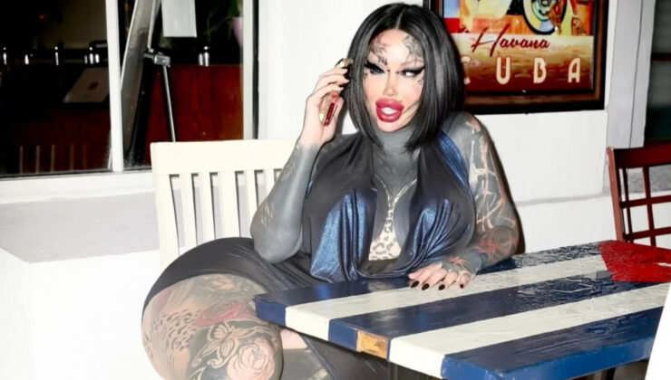 Estetik ameliyatlarıyla ünlü model hayatını kaybetti