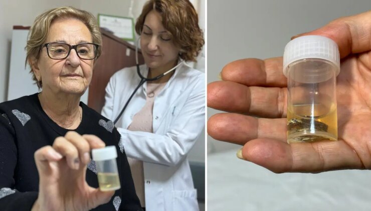 Hapı ‘alüminyum kabıyla’ yuttu: Akciğerinden 4 yıl sonra çıkarıldı