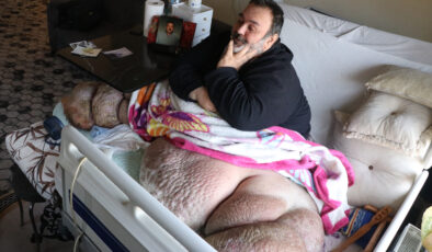 Kayseri’de fil hastası adam 300 kiloya ulaştı: 5 yıldır dışarı çıkamıyor