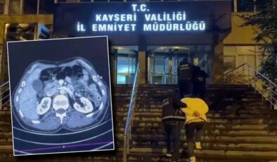 Kayseri’de operasyon: Midesinden uyuşturucu çıkan 3 İranlı gözaltında