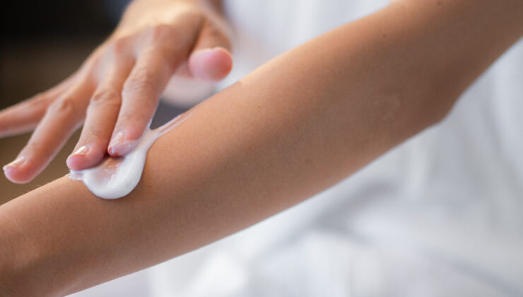 Kış aylarında soğuk hava cildi kurutuyor: Kızarık ve kaşıntılı ciltler dikkat etmeli