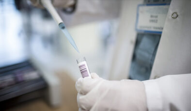 Maymun çiçeği virüsünün yeni bir türü tespit edildi