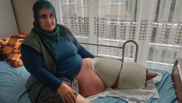 Mersin’de fil hastalığıyla mücadele ediyor