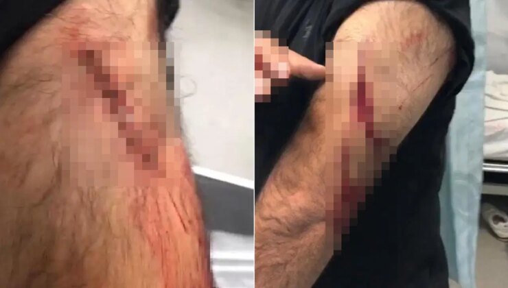 Şanlıurfa’da öğretmene sokak ortasında jiletli saldırı!