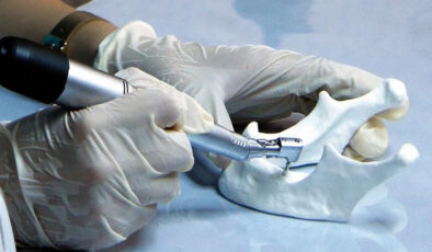 SGK implant tedavisini karşılıyor mu? Ücretsiz implant şartları 2025