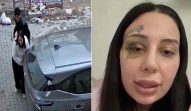 Sokak ortasındaki şiddet görüntülerine tepki yağmıştı… Eşinin silah çekip darbettiği Yağmur: Hamile kaldım evlendik şiddet başladı