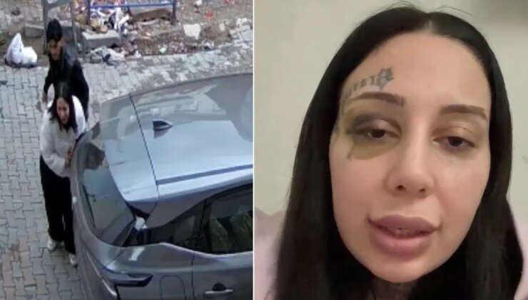 Sokak ortasındaki şiddet görüntülerine tepki yağmıştı… Eşinin silah çekip darbettiği Yağmur: Hamile kaldım evlendik şiddet başladı