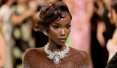 Ünlü model Anok Yai sessizce mücadele ettiği hastalığını açıkladı