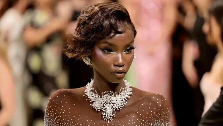 Ünlü model Anok Yai sessizce mücadele ettiği hastalığını açıkladı