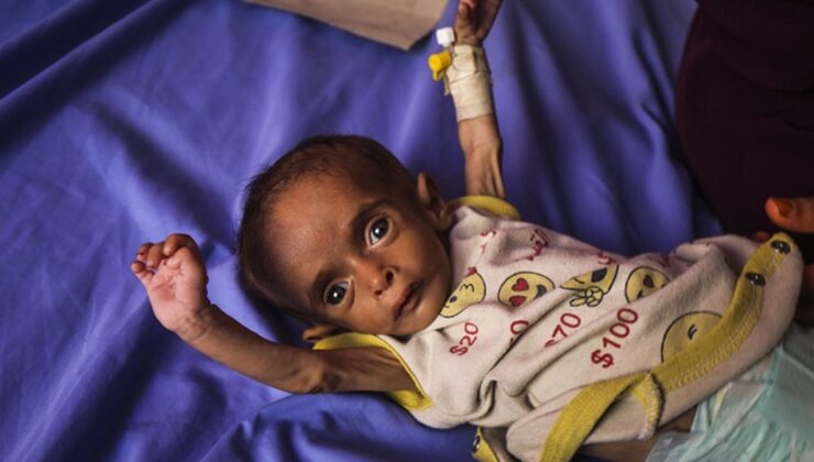 DSÖ: Gazze’de 18 bin 500’den fazla hastanın tahliye edilmesi gerekiyor